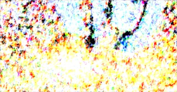 Indemnisation accident : les clés pour défendre vos droits